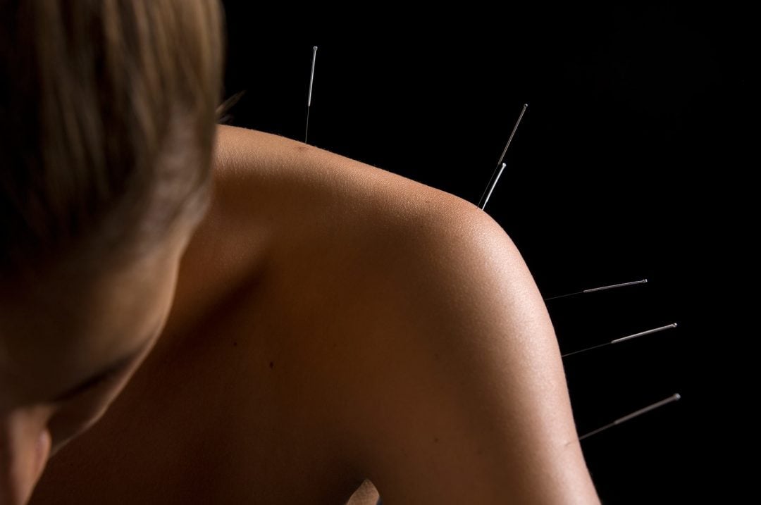 H&Z Acupuncture
