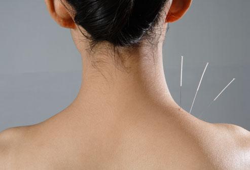 Patient Experiences - H&Z Acupuncture - Advanced Acupuncture Clinic